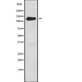 WDHD1 Antibody - Western blot analysis of WDHD1 using HeLa whole cells lysates