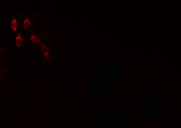 WDHD1 Antibody - Staining HeLa cells by IF/ICC. The samples were fixed with PFA and permeabilized in 0.1% Triton X-100, then blocked in 10% serum for 45 min at 25°C. The primary antibody was diluted at 1:200 and incubated with the sample for 1 hour at 37°C. An Alexa Fluor 594 conjugated goat anti-rabbit IgG (H+L) Ab, diluted at 1/600, was used as the secondary antibody.