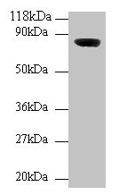 WDPCP / FRITZ Antibody - Western blot All lanes: WD repeat-containing and planar cell polarity effector protein fritz homolog antibody at 2µg/ml + Mouse brain tissue Secondary Goat polyclonal to rabbit IgG at 1/10000 dilution Predicted band size: 82, 73 kDa Observed band size: 82 kDa