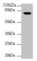 WDPCP / FRITZ Antibody - Western blot All lanes: WD repeat-containing and planar cell polarity effector protein fritz homolog antibody at 2µg/ml + Mouse brain tissue Secondary Goat polyclonal to rabbit IgG at 1/10000 dilution Predicted band size: 82, 73 kDa Observed band size: 82 kDa