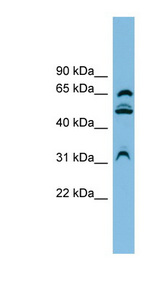 WDR1 Antibody - WDR1 antibody Western blot of HT1080 cell lysate. This image was taken for the unconjugated form of this product. Other forms have not been tested.
