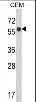 WDR1 Antibody - Western blot of WDR1 Antibody in CEM cell line lysates (35 ug/lane). WDR1 (arrow) was detected using the purified antibody.