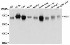 WDR1 Antibody - Western blot analysis of extracts of various cell lines, using WDR1 antibody at 1:3000 dilution. The secondary antibody used was an HRP Goat Anti-Rabbit IgG (H+L) at 1:10000 dilution. Lysates were loaded 25ug per lane and 3% nonfat dry milk in TBST was used for blocking. An ECL Kit was used for detection and the exposure time was 1s.