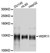 WDR11 / BRWD2 Antibody - Western blot analysis of extracts of various cell lines, using WDR11 antibody at 1:1000 dilution. The secondary antibody used was an HRP Goat Anti-Rabbit IgG (H+L) at 1:10000 dilution. Lysates were loaded 25ug per lane and 3% nonfat dry milk in TBST was used for blocking. An ECL Kit was used for detection and the exposure time was 30s.