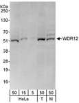WDR12 Antibody - Detection of Human and Mouse WDR12 by Western Blot. Samples: Whole cell lysate from HeLa (5, 15 and 50 ug), 293T (T; 50 ug), and mouse NIH3T3 (M; 50 ug) cells. Antibody: Affinity purified rabbit anti-WDR12 antibody used for WB at 0.1 ug/ml. Detection: Chemiluminescence with an exposure time of 30 seconds.