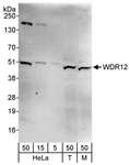 WDR12 Antibody - Detection of Human and Mouse WDR12 by Western Blot. Samples: Whole cell lysate from HeLa (5, 15 and 50 ug), 293T (T; 50 ug), and mouse NIH3T3 (M; 50 ug) cells. Antibody: Affinity purified rabbit anti-WDR12 antibody used for WB at 0.1 ug/ml. Detection: Chemiluminescence with an exposure time of 3 minutes.