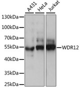 WDR12 Antibody - Western blot analysis of extracts of various cell lines, using WDR12 antibody at 1:1000 dilution. The secondary antibody used was an HRP Goat Anti-Rabbit IgG (H+L) at 1:10000 dilution. Lysates were loaded 25ug per lane and 3% nonfat dry milk in TBST was used for blocking. An ECL Kit was used for detection and the exposure time was 30s.