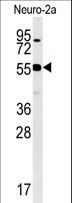 WDR18 Antibody - WDR18 Antibody western blot of Neuro-2a cell line lysates (35 ug/lane). The WDR18 antibody detected the WDR18 protein (arrow).