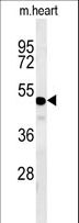 WDR18 Antibody - WDR18 Antibody western blot of mouse heart tissue lysates (35 ug/lane). The WDR18 antibody detected the WDR18 protein (arrow).
