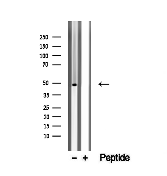 WDR18 Antibody - Western blot analysis of extracts of Jurkat cells using WDR18 antibody.