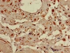 WDR19 Antibody - Immunohistochemistry of paraffin-embedded human placenta tissue using WDR19 Antibody at dilution of 1:100