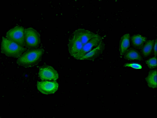 WDR19 Antibody - Immunofluorescent analysis of A549 cells using WDR19 Antibody at a dilution of 1:100 and Alexa Fluor 488-congugated AffiniPure Goat Anti-Rabbit IgG(H+L)