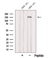 WDR19 Antibody - Western blot analysis of extracts of HEK293 cells using WDR19/IFT144 antibody. The lane on the left was treated with blocking peptide.