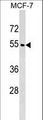WDR20 Antibody - WDR20 Antibody western blot of MCF-7 cell line lysates (35 ug/lane). The WDR20 antibody detected the WDR20 protein (arrow).