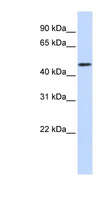 WDR21A / DCAF4 Antibody - DCAF4 / WDR21A antibody Western blot of Fetal Muscle lysate. This image was taken for the unconjugated form of this product. Other forms have not been tested.