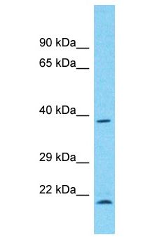 WDR21A / DCAF4 Antibody - WDR21A / DCAF4 antibody Western Blot of COLO205. Antibody dilution: 1 ug/ml.  This image was taken for the unconjugated form of this product. Other forms have not been tested.