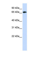 WDR21A / DCAF4 Antibody - DCAF4 / WDR21A antibody Western blot of Fetal Muscle lysate. This image was taken for the unconjugated form of this product. Other forms have not been tested.
