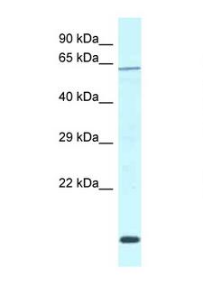 WDR23 / DCAF11 Antibody - DCAF11 / WDR23 antibody Western blot of Mouse Pancreas lysate. Antibody concentration 1 ug/ml.  This image was taken for the unconjugated form of this product. Other forms have not been tested.