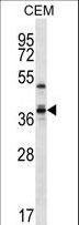 WDR25 Antibody - WDR25 Antibody western blot of CEM cell line lysates (35 ug/lane). The WDR25 antibody detected the WDR25 protein (arrow).