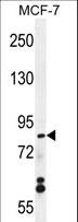 WDR27 Antibody - WDR27 Antibody western blot of MCF-7 cell line lysates (35 ug/lane). The WDR27 antibody detected the WDR27 protein (arrow).