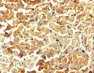 WDR27 Antibody - Immunohistochemistry of paraffin-embedded human heart tissue using WDR27 Antibody at dilution of 1:100