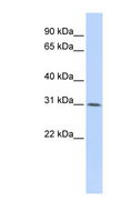 WDR33 Antibody - WDR33 antibody Western blot of HepG2 cell lysate. This image was taken for the unconjugated form of this product. Other forms have not been tested.