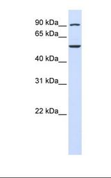 WDR34 Antibody - Fetal brain lysate. Antibody concentration: 1.0 ug/ml. Gel concentration: 12%.  This image was taken for the unconjugated form of this product. Other forms have not been tested.