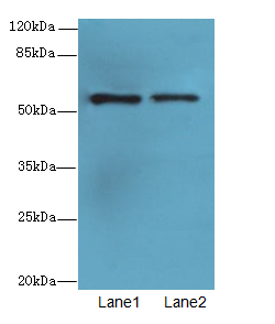 WDR34 Antibody - Western blot. All lanes: WDR34 antibody at 1.5 ug/ml. Lane 1: PC-3 whole cell lysate. Lane 2: MDA-MB-231 whole cell lysate. Secondary Goat polyclonal to Rabbit IgG at 1:10000 dilution. Predicted band size: 58 kDa. Observed band size: 58 kDa.