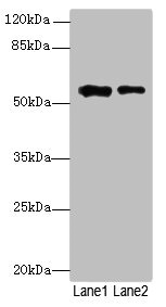 WDR34 Antibody - Western blot All lanes: WDR34 antibody at 1.5µg/ml Lane 1: PC-3 whole cell lysate Lane 2: MDA-MB-231 whole cell lysate Secondary Goat polyclonal to rabbit IgG at 1/10000 dilution Predicted band size: 58 kDa Observed band size: 58 kDa