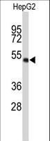 WDR37 Antibody - Western blot of WDR37 Antibody in HepG2 cell line lysates (35 ug/lane). WDR37 (arrow) was detected using the purified antibody.