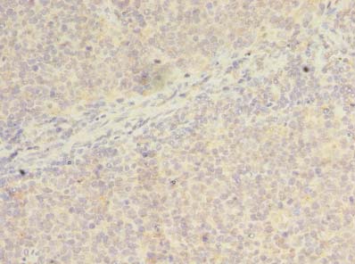 WDR37 Antibody - Immunohistochemistry of paraffin-embedded human tonsil tissue using antibody at dilution of 1:100.