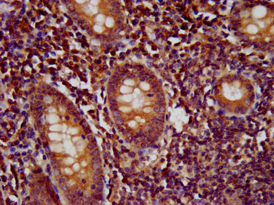 WDR37 Antibody - IHC image of Wdr37 Antibody diluted at 1:500 and staining in paraffin-embedded human appendix tissue performed on a Leica BondTM system. After dewaxing and hydration, antigen retrieval was mediated by high pressure in a citrate buffer (pH 6.0). Section was blocked with 10% normal goat serum 30min at RT. Then primary antibody (1% BSA) was incubated at 4°C overnight. The primary is detected by a biotinylated secondary antibody and visualized using an HRP conjugated SP system.