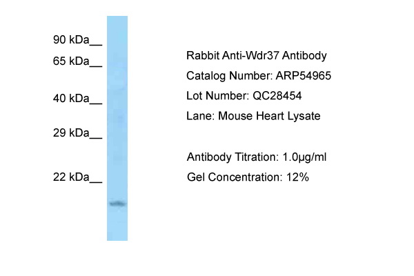 WDR37 Antibody -  This image was taken for the unconjugated form of this product. Other forms have not been tested.