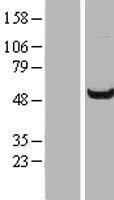 WDR37 Protein - Western validation with an anti-DDK antibody * L: Control HEK293 lysate R: Over-expression lysate