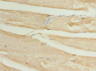 WDR38 Antibody - Immunohistochemistry of paraffin-embedded human skeletal muscle tissue at dilution 1:100