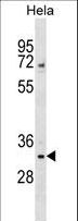 WDR4 Antibody - WDR4 Antibody western blot of HeLa cell line lysates (35 ug/lane). The WDR4 antibody detected the WDR4 protein (arrow).