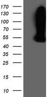WDR4 Antibody - HEK293T cells were transfected with the pCMV6-ENTRY control (Left lane) or pCMV6-ENTRY WDR4 (Right lane) cDNA for 48 hrs and lysed. Equivalent amounts of cell lysates (5 ug per lane) were separated by SDS-PAGE and immunoblotted with anti-WDR4.