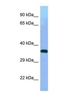 WDR41 Antibody - WDR41 antibody Western blot of Small Intestine lysate. Antibody concentration 1 ug/ml.  This image was taken for the unconjugated form of this product. Other forms have not been tested.