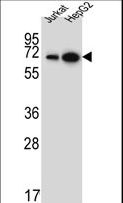 WDR43 Antibody - WDR43 Antibody western blot of Jurkat,HepG2 cell line lysates (35 ug/lane). The WDR43 antibody detected the WDR43 protein (arrow).
