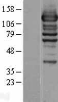 WDR44 Protein - Western validation with an anti-DDK antibody * L: Control HEK293 lysate R: Over-expression lysate