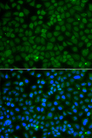 WDR45 Antibody - Immunofluorescence blot of A549 cell using WDR45 antibody. Blue: DAPI for nuclear staining.