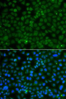 WDR45 Antibody - Immunofluorescence blot of A549 cell using WDR45 antibody. Blue: DAPI for nuclear staining.