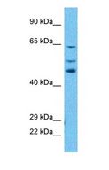 WDR46 Antibody - Western blot of WDR46 Antibody with human HepG2 Whole Cell lysate.  This image was taken for the unconjugated form of this product. Other forms have not been tested.