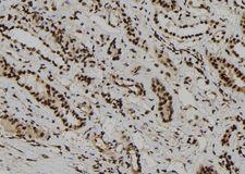 WDR46 Antibody - 1:100 staining human kidney tissue by IHC-P. The sample was formaldehyde fixed and a heat mediated antigen retrieval step in citrate buffer was performed. The sample was then blocked and incubated with the antibody for 1.5 hours at 22°C. An HRP conjugated goat anti-rabbit antibody was used as the secondary.