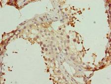 WDR47 Antibody - Immunohistochemistry of paraffin-embedded human testis tissue at dilution 1:100