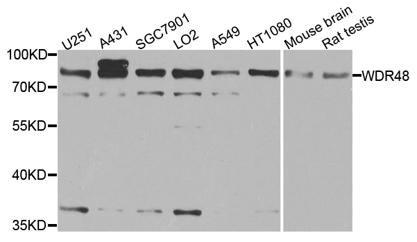 WDR48 Antibody - Western blot blot of extracts of various cell lines, using WDR48 antibody.