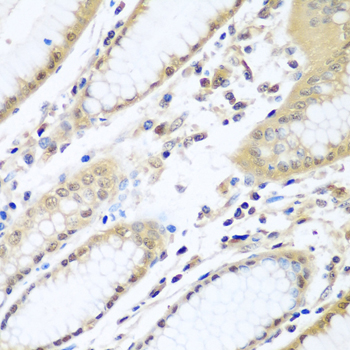 WDR48 Antibody - Immunohistochemistry of paraffin-embedded human stomach using WDR48 antibody at dilution of 1:100 (40x lens).