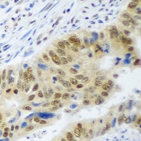 WDR48 Antibody - Immunohistochemical analysis of WDR48 staining in human colon formalin fixed paraffin embedded tissue section. The section was pre-treated using heat mediated antigen retrieval with sodium citrate buffer (pH 6.0). The section was then incubated with the antibody at room temperature and detected using an HRP conjugated compact polymer system. DAB was used as the chromogen. The section was then counterstained with hematoxylin and mounted with DPX.