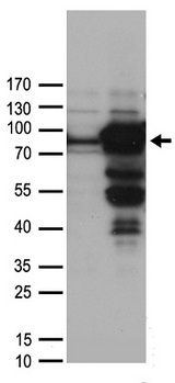 WDR48 Antibody - HEK293T cells were transfected with the pCMV6-ENTRY control. (Left lane) or pCMV6-ENTRY WDR48. (Right lane) cDNA for 48 hrs and lysed