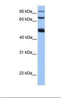 WDR49 Antibody - Hela cell lysate. Antibody concentration: 1.0 ug/ml. Gel concentration: 12%.  This image was taken for the unconjugated form of this product. Other forms have not been tested.